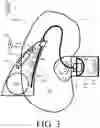Fig. 05 - Hearing device comprising a microphone adapted to be located at or in the ear canal of a user