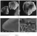 Fig. 04 - METHOD FOR OBTAINING A GRANULATED FOOD MATERIAL