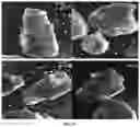Fig. 09 - METHOD FOR OBTAINING A GRANULATED FOOD MATERIAL