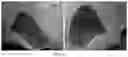 Fig. 14 - METHOD FOR OBTAINING A GRANULATED FOOD MATERIAL
