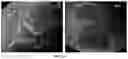 Fig. 15 - METHOD FOR OBTAINING A GRANULATED FOOD MATERIAL