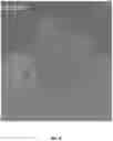 Fig. 06 - Thermal Imaging Device Performing Image Analysis To Facilitate Early Detection Of Distal Extremity Altered Perfusion States