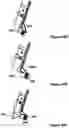 Fig. 49 - Local Control Robotic Surgical Devices and Related Methods