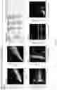 Fig. 197 - SELECTION OF IMPROVED TUMOR REACTIVE T-CELLS