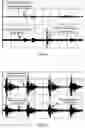 Fig. 09 - Method and device for monitoring partial discharge