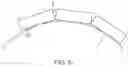 Fig. 07 - Absorbable intravascular devices that shorten upon expansion creating space for vascular movement