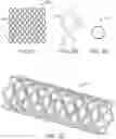 Fig. 08 - Absorbable intravascular devices that shorten upon expansion creating space for vascular movement