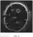 Fig. 18 - Absorbable intravascular devices that shorten upon expansion creating space for vascular movement
