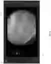 Fig. 07 - Systems and methods for detection and analysis of polyps in colon images