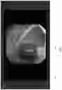 Fig. 08 - Systems and methods for detection and analysis of polyps in colon images