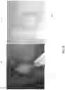 Fig. 09 - Systems and methods for detection and analysis of polyps in colon images