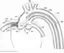 Fig. 01 - OSTIAL STENT DELIVERY DEVICE, SYSTEM, AND METHOD