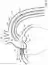 Fig. 07 - OSTIAL STENT DELIVERY DEVICE, SYSTEM, AND METHOD