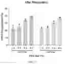 Fig. 08 - Inhalable therapeutics