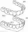 Fig. 01 - ACCESSORY AND ASSEMBLY OF ACCESSORY AND SHELL-SHAPED TOOTH REPOSITIONER