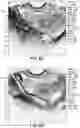 Fig. 09 - PROGESTERONE FORMULATION TO TRIGGER OVULATION AND PROVIDE LUTEAL PHASE SUPPORT