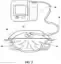 Fig. 08 - Apparatus for cutting a material and a method for cutting a negative pressure wound therapy dressing