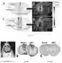 Fig. 08 - Planning and delivery of dynamically oriented electric field for biomedical applications