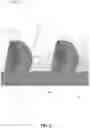 Fig. 04 - BONE FIXATION DEVICES, SYSTEMS, METHODS, AND INSTRUMENTS
