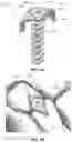 Fig. 09 - BONE FIXATION DEVICES, SYSTEMS, METHODS, AND INSTRUMENTS