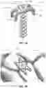 Fig. 10 - BONE FIXATION DEVICES, SYSTEMS, METHODS, AND INSTRUMENTS