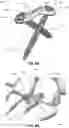 Fig. 11 - BONE FIXATION DEVICES, SYSTEMS, METHODS, AND INSTRUMENTS