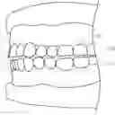 Fig. 01 - Method of operating intraoral scanner for fast and accurate full mouth reconstruction