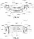Fig. 35 - Textile seal with air-assisted biasing portion