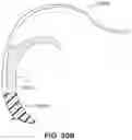 Fig. 79 - Textile seal with air-assisted biasing portion
