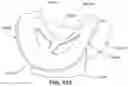 Fig. 99 - Textile seal with air-assisted biasing portion