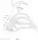 Fig. 02 - METHOD, APPARATUS AND KIT FOR TREATING CHRONIC AND LONG-TERM NASAL CONGESTION