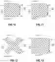 Fig. 09 - Flexible and/or deformable mechanical elements with radiographic markers