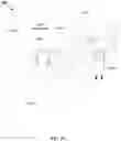 Fig. 30 - System and method for intraoperatively determining image alignment