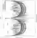 Fig. 07 - METHOD AND SYSTEM OF PULSE-ECHO ULTRASOUND IMAGING USING PSEUDO-RANDOM SPARSE ARRAYS