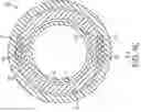 Fig. 09 - Device and method for removing material from a hollow anatomical structure