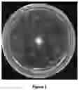 Fig. 02 - REDUCING MALARIA TRANSMISSION