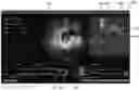Fig. 01 - AUTOMATIC INTRALUMINAL IMAGING-BASED TARGET AND REFERENCE IMAGE FRAME DETECTION AND ASSOCIATED DEVICES, SYSTEMS, AND METHODS
