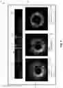 Fig. 06 - AUTOMATIC INTRALUMINAL IMAGING-BASED TARGET AND REFERENCE IMAGE FRAME DETECTION AND ASSOCIATED DEVICES, SYSTEMS, AND METHODS