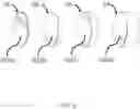 Fig. 07 - Deicing and snow melting compositions and methods of use