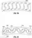 Fig. 22 - Circular surgical stapler having staples with expandable crowns