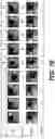 Fig. 09 - DEVICES AND METHODS FOR AUTOMATED DELIVERY OF OPHTHALMOLOGICAL MEDICATIONS