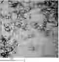 Fig. 01 - Composition comprising PIC for treatment of cancer