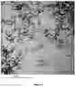 Fig. 02 - Composition comprising PIC for treatment of cancer