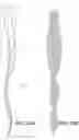 Fig. 33 - Endodontic instruments