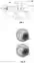 Fig. 02 - SYSTEM AND METHOD FOR OBTAINING BIOMECHANICAL PARAMETERS OF OCULAR TISSUE THROUGH DEFORMATION OF THE OCULAR TISSUE