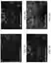 Fig. 22 - GENE EDITING USING A MESSENGER RIBONUCLEIC ACID CONSTRUCT