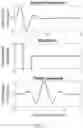Fig. 12 - SPARSE SYNTHETIC APERTURE ULTRASOUND METHODS AND SYSTEMS