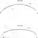 Fig. 04 - Corneal implant