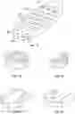 Fig. 04 - SYSTEMS AND METHODS FOR ORTHOPEDIC IMPLANT FIXATION