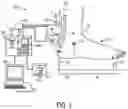 Fig. 02 - Tissue Load Sensor with Reduced Calibration Requirements